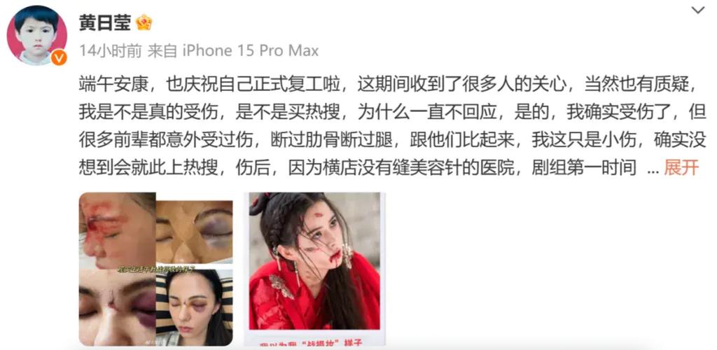 知名演员突发意外!吊威亚从高空摔下,工作室回应