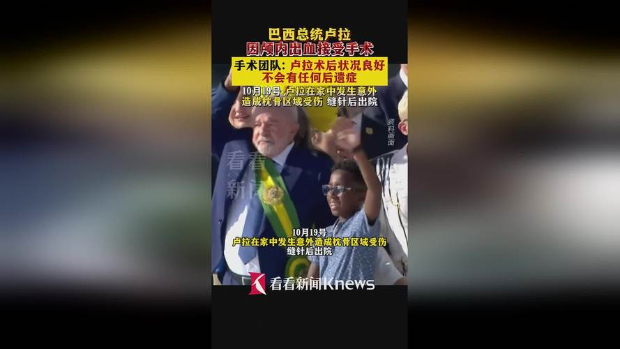 外媒:巴西总统卢拉接受脑出血手术